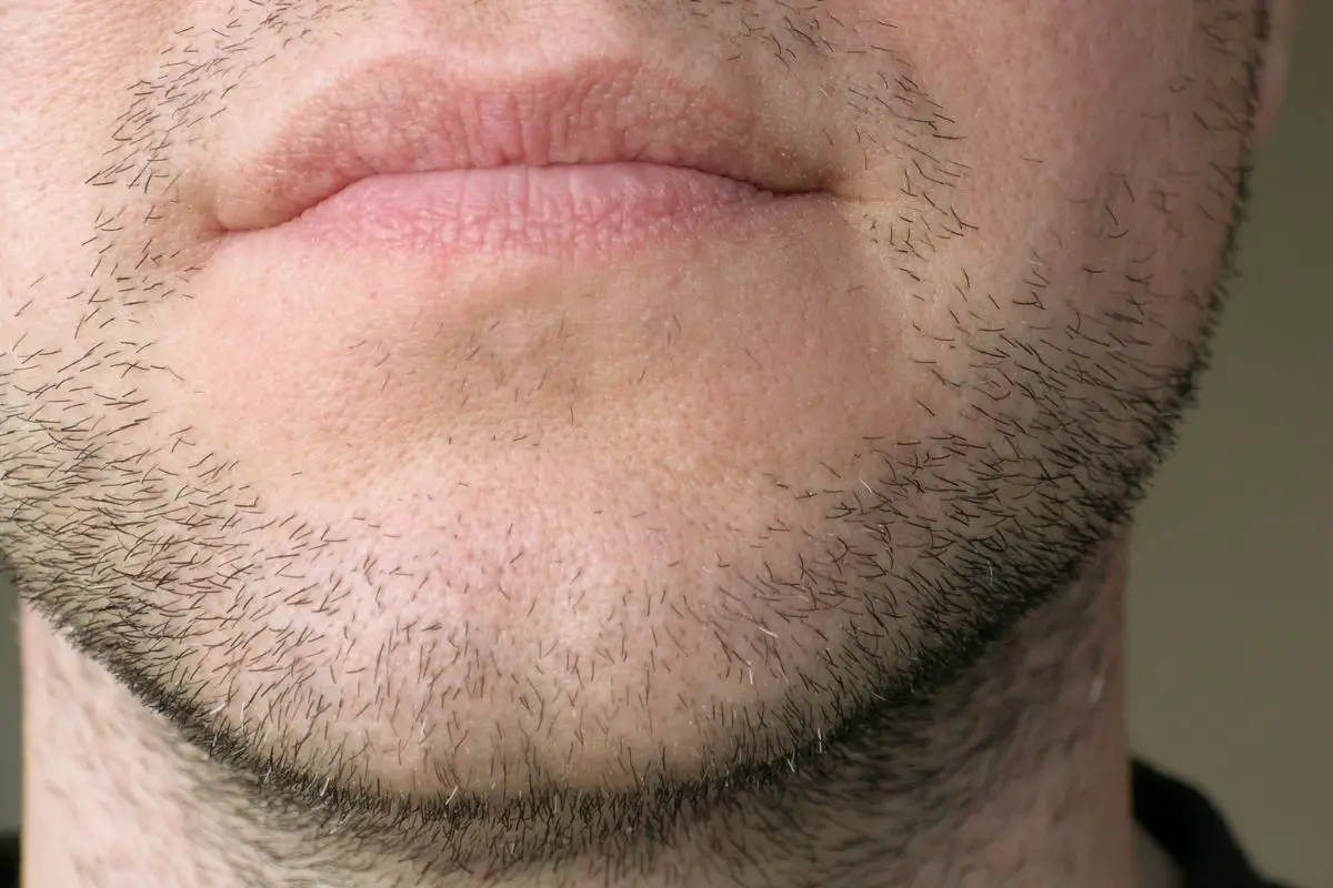 How To Get Rid Of Stubble